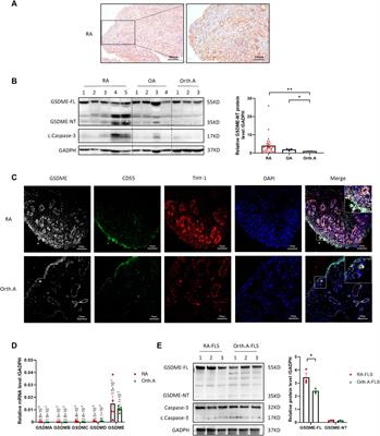 Gasdermin-E Mediated Pyroptosis—A Novel Mechanism Regulating Migration, Invasion and Release of Inflammatory Cytokines in Rheumatoid Arthritis Fibroblast-like Synoviocytes